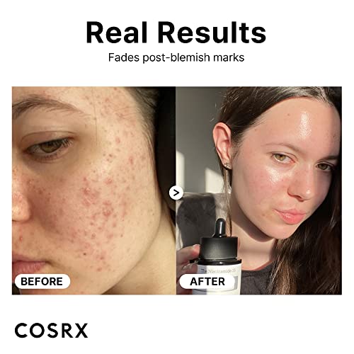 The Niacinamide 15